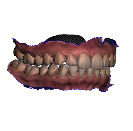 53