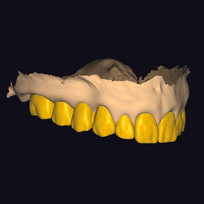 e44