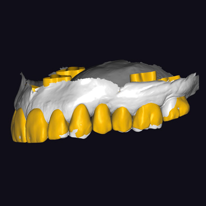 e491