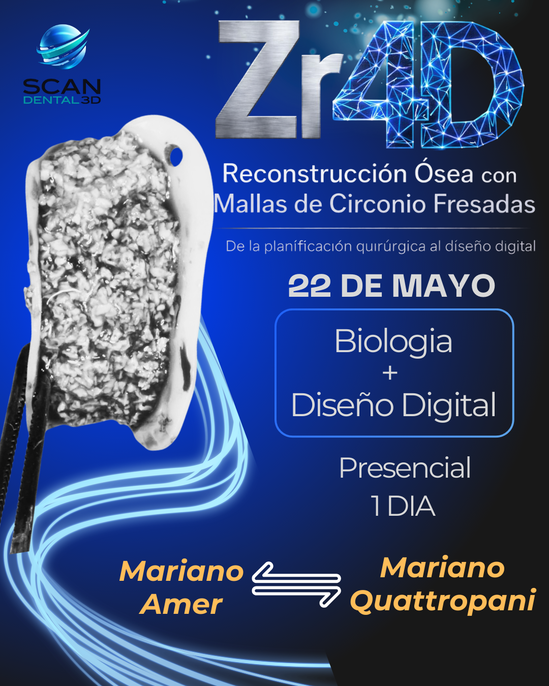 ZR4D (1)